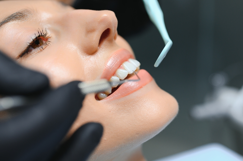 Understanding Gingivectomy: Procedures and Benefits in Phoenix